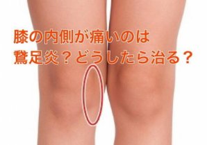 膝の内側が痛いのは鵞足炎？それって治るの？